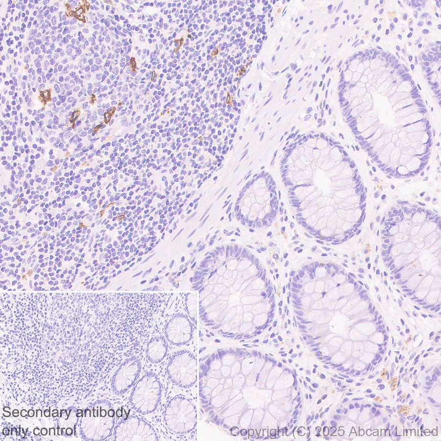 Immunohistochemistry (Formalin/PFA-fixed paraffin-embedded sections) - Anti-TIM 4 antibody [EPR29500-15] (ab323572), expandable thumbnail