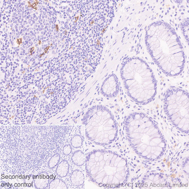 Immunohistochemistry (Formalin/PFA-fixed paraffin-embedded sections) - Anti-TIM 4 antibody [EPR29500-15] (AB323572)