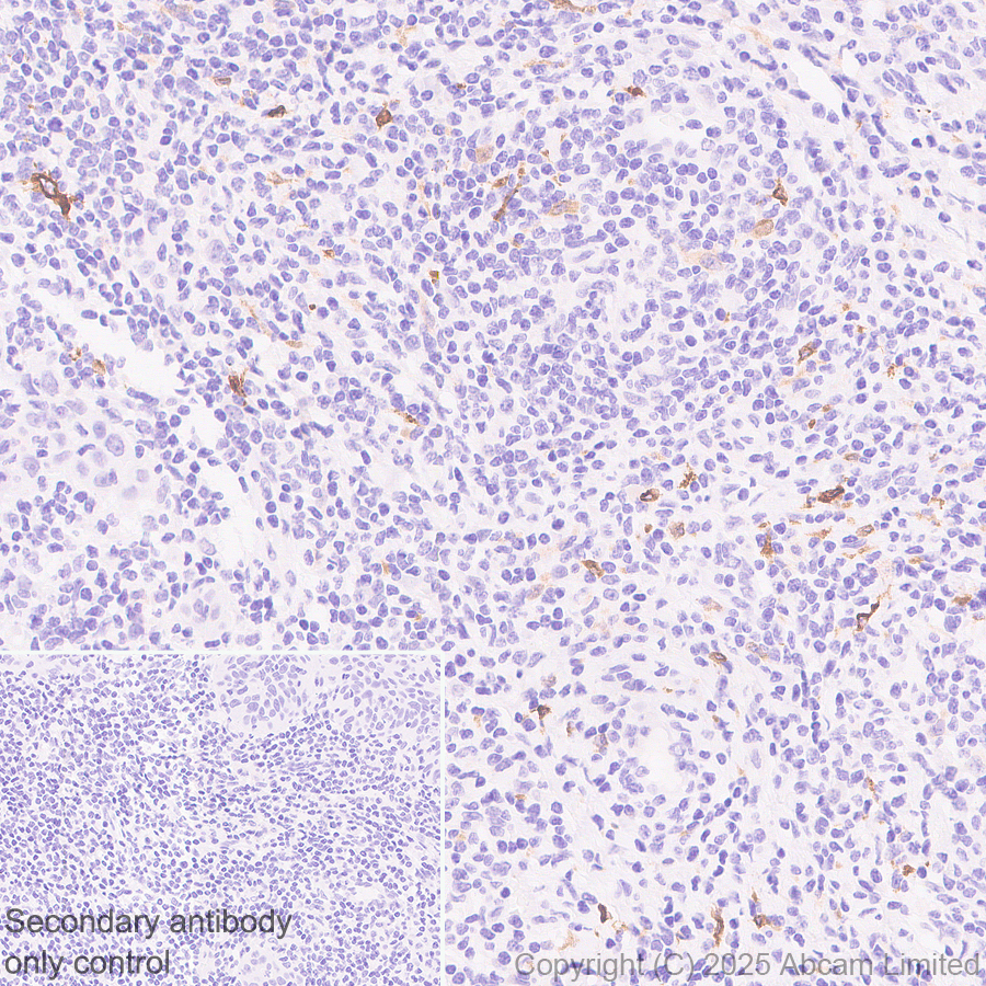Immunohistochemistry (Formalin/PFA-fixed paraffin-embedded sections) - Anti-TIM 4 antibody [EPR29500-15] (ab323572), expandable thumbnail
