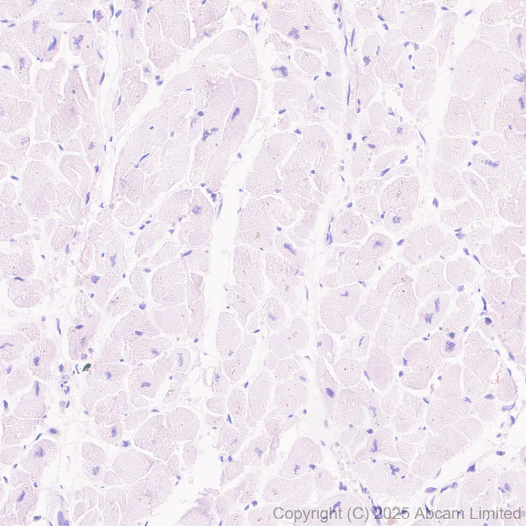 Immunohistochemistry (Formalin/PFA-fixed paraffin-embedded sections) - Anti-TIM 4 antibody [EPR29500-15] (AB323572)