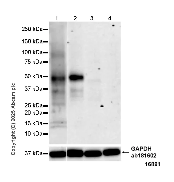 Western blot - Anti-TIM 4 antibody [EPR29500-15] (AB323572)