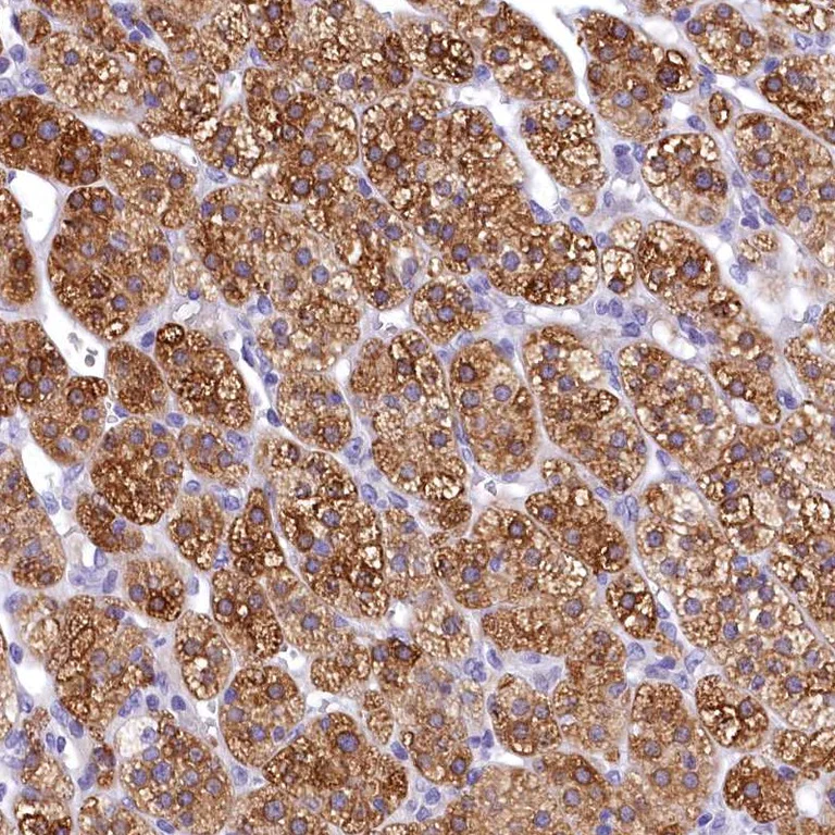 Immunohistochemistry (Formalin/PFA-fixed paraffin-embedded sections) - Anti-TIM22 antibody (AB251909)