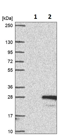 Western blot - Anti-TIM22 antibody (AB251909)