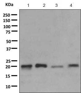 Western blot - Anti-TIM22 antibody [EPR9973] (AB167423)