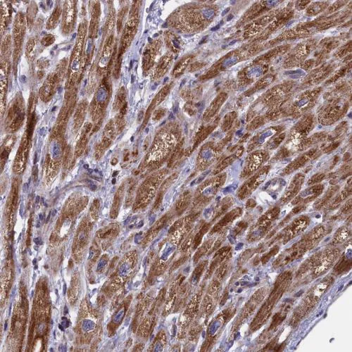 Immunohistochemistry (Formalin/PFA-fixed paraffin-embedded sections) - Anti-TIM44 antibody (AB244466)