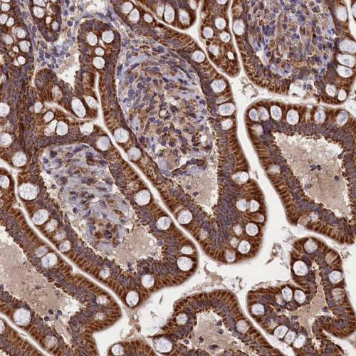 Immunohistochemistry (Formalin/PFA-fixed paraffin-embedded sections) - Anti-TIM44 antibody (AB244466)
