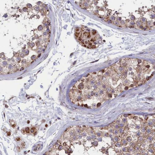 Immunohistochemistry (Formalin/PFA-fixed paraffin-embedded sections) - Anti-TIM44 antibody (AB244466)