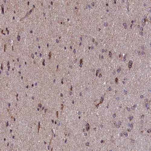 Immunohistochemistry (Formalin/PFA-fixed paraffin-embedded sections) - Anti-TIM44 antibody (AB244466)