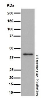 Western blot - Anti-TIM44 antibody [EPR16821] (AB194829), expandable thumbnail