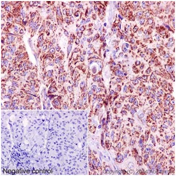 Immunohistochemistry (Formalin/PFA-fixed paraffin-embedded sections) - Anti-TIM44 antibody [EPR16821] - BSA and Azide free (AB251197)