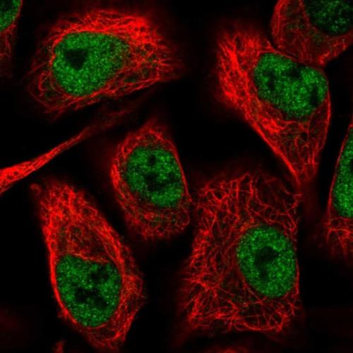 Immunocytochemistry/ Immunofluorescence - Anti-TIM50 antibody (AB204486)