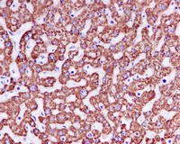 Immunohistochemistry (Formalin/PFA-fixed paraffin-embedded sections) - Anti-TIM50 antibody [EPR5784] (AB109527)