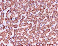 Immunohistochemistry (Formalin/PFA-fixed paraffin-embedded sections) - Anti-TIM50 antibody [EPR5784] (AB109527)