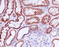Immunohistochemistry (Formalin/PFA-fixed paraffin-embedded sections) - Anti-TIM50 antibody [EPR5784] (AB109527)