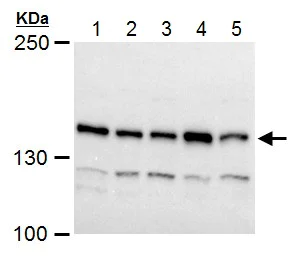 Western blot - Anti-Timeless antibody (AB229218)
