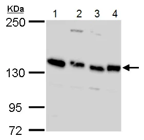 Western blot - Anti-Timeless antibody (AB229218)