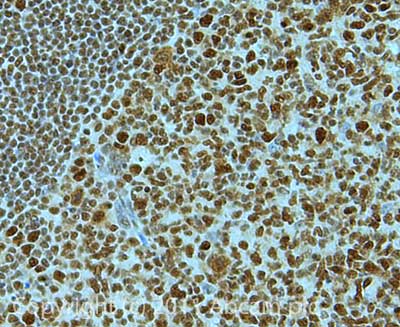 Immunohistochemistry (Formalin/PFA-fixed paraffin-embedded sections) - Anti-Timeless antibody (AB72458)
