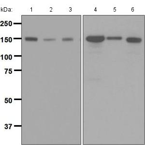 Western blot - Anti-Timeless antibody [EPR5274(2)] (AB133569), expandable thumbnail