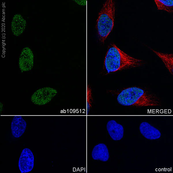 Immunocytochemistry/ Immunofluorescence - Anti-Timeless antibody [EPR5275] (AB109512)