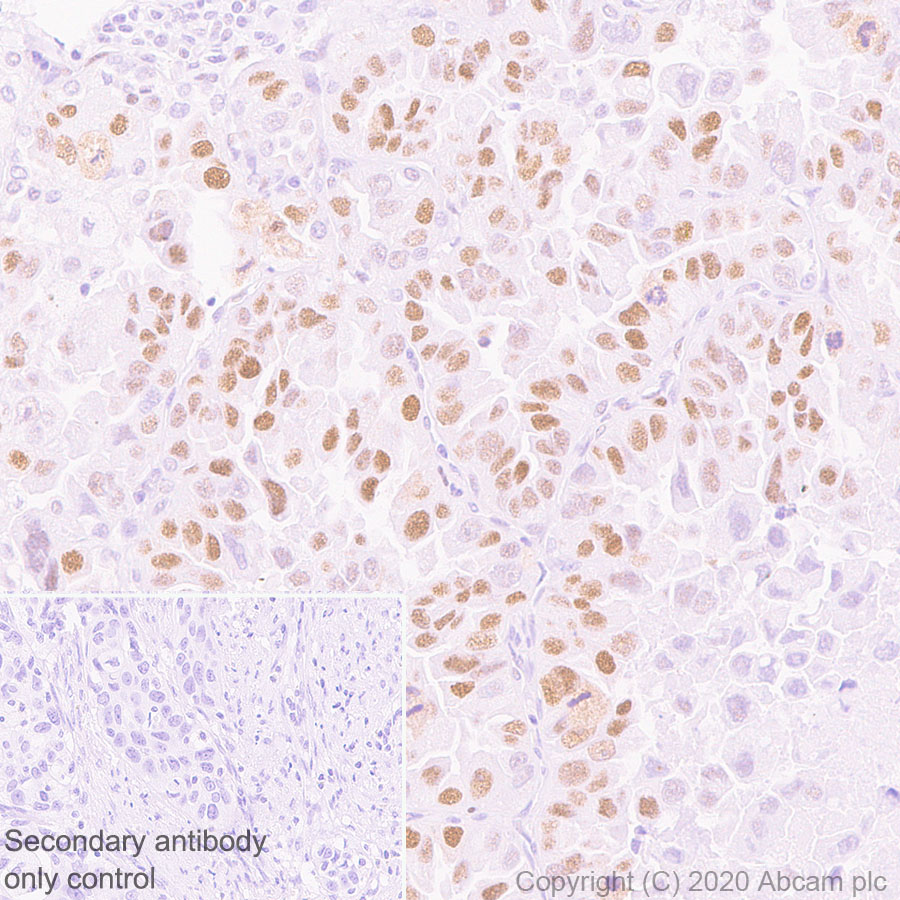 Immunohistochemistry (Formalin/PFA-fixed paraffin-embedded sections) - Anti-Timeless antibody [EPR5275] (AB109512)