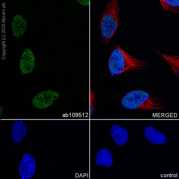 Immunocytochemistry/ Immunofluorescence - Anti-Timeless antibody [EPR5275] - BSA and Azide free (AB239982)