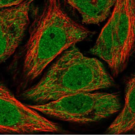 Immunocytochemistry/ Immunofluorescence - Anti-TIMM17A/TIM17 antibody (AB150785)