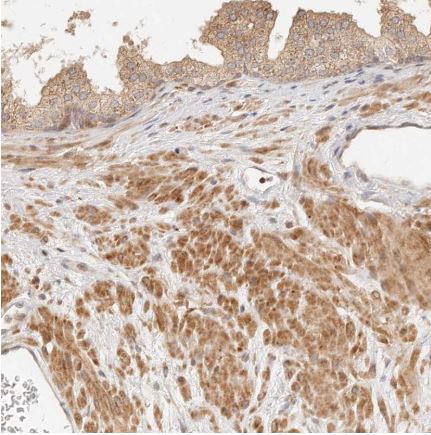 Immunohistochemistry (Formalin/PFA-fixed paraffin-embedded sections) - Anti-TIMM17A/TIM17 antibody (AB150785)