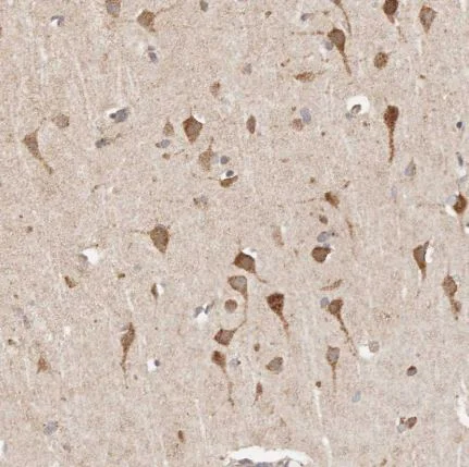 Immunohistochemistry (Formalin/PFA-fixed paraffin-embedded sections) - Anti-TIMM17A/TIM17 antibody (AB150785)