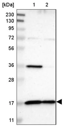 Western blot - Anti-TIMM17A/TIM17 antibody (AB150785)