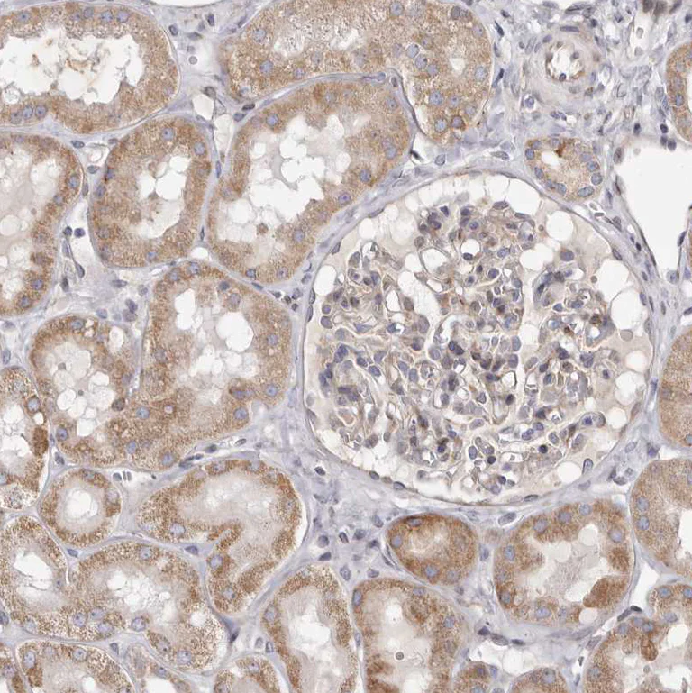 Immunohistochemistry (Formalin/PFA-fixed paraffin-embedded sections) - Anti-TIMM17B antibody (AB122034)