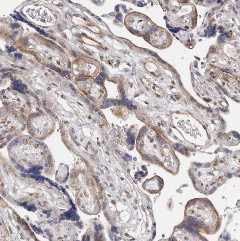 Immunohistochemistry (Formalin/PFA-fixed paraffin-embedded sections) - Anti-TIMM17B antibody (AB122034)