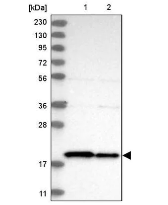 Western blot - Anti-TIMM17B antibody (AB122034)