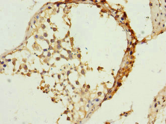 Immunohistochemistry (Formalin/PFA-fixed paraffin-embedded sections) - Anti-TIMM23/TIM23 antibody (AB230253)