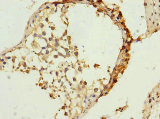 Immunohistochemistry (Formalin/PFA-fixed paraffin-embedded sections) - Anti-TIMM23/TIM23 antibody (AB230253)