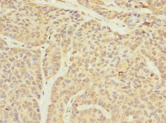 Immunohistochemistry (Formalin/PFA-fixed paraffin-embedded sections) - Anti-TIMM23/TIM23 antibody (AB230253)