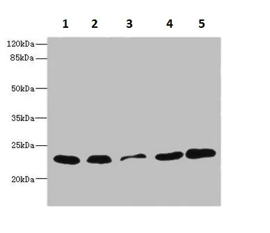 Western blot - Anti-TIMM23/TIM23 antibody (AB230253)