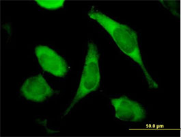 Immunocytochemistry/ Immunofluorescence - Anti-TIMM8A/DDP antibody (AB88311), expandable thumbnail