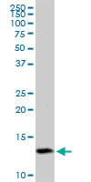Western blot - Anti-TIMM8A/DDP antibody (AB88311), expandable thumbnail