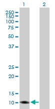 Western blot - Anti-TIMM8A/DDP antibody (AB88311), expandable thumbnail