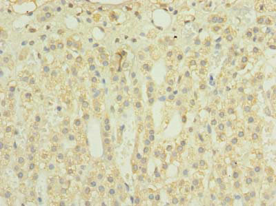 Immunohistochemistry (Formalin/PFA-fixed paraffin-embedded sections) - Anti-TIMM8B antibody (AB238738), expandable thumbnail