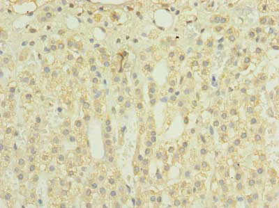 Immunohistochemistry (Formalin/PFA-fixed paraffin-embedded sections) - Anti-TIMM8B antibody (AB238738)