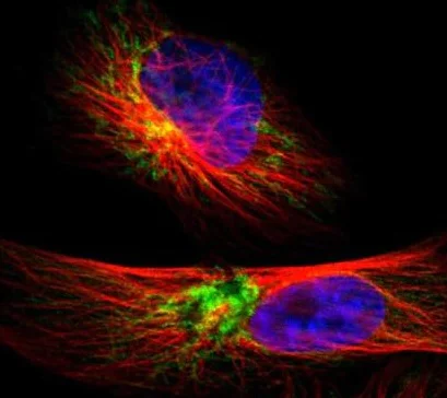 Immunocytochemistry/ Immunofluorescence - Anti-TIMM9 antibody (AB224320)