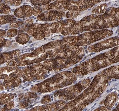 Immunohistochemistry (Formalin/PFA-fixed paraffin-embedded sections) - Anti-TIMM9 antibody (AB224320)