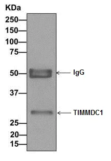 Immunoprecipitation - Anti-TIMMDC1/C3orf1 antibody [EPR11807] (AB171978)