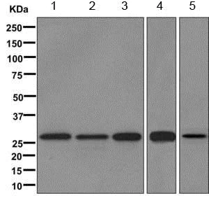 Western blot - Anti-TIMMDC1/C3orf1 antibody [EPR11807] - BSA and Azide free (AB249690)