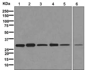 Western blot - Anti-TIMMDC1/C3orf1 antibody [EPR11808] - BSA and Azide free (AB249668)