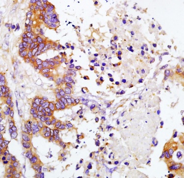 Immunohistochemistry (Formalin/PFA-fixed paraffin-embedded sections) - Anti-TIMP1 antibody (AB216432)