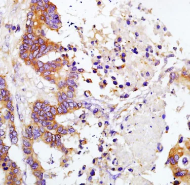Anti-TIMP1 antibody (ab216432) | Abcam
