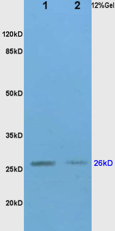 Western blot - Anti-TIMP1 antibody (AB216432)
