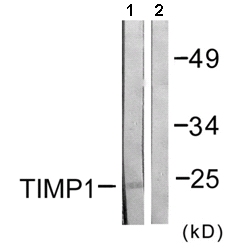 Western blot - Anti-TIMP1 antibody (AB61224)